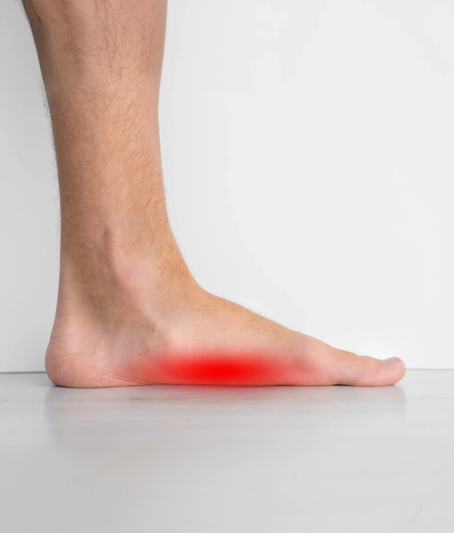 A foot with a low, flattened arch on standing