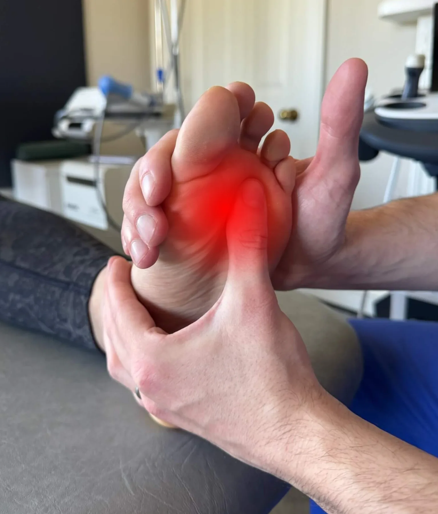 The ball of the foot between the toes, where a Morton's neuroma causes nerve pain